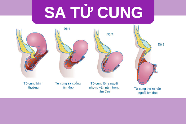 sa-tu-cung-va-nhung-thong-tin-dung-bo-qua-1