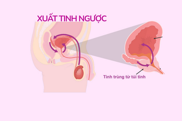 tai-sao-quan-he-khong-xuat-tinh-va-khac-phuc-the-nao-2