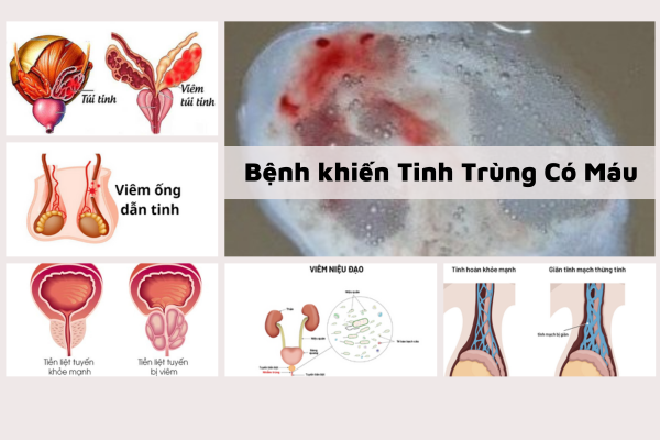 tinh-trung-co-mau-dau-hieu-khong-the-xem-thuong-1