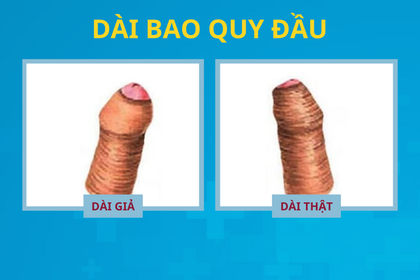 diem-danh-cac-benh-o-bao-quy-dau-thuong-gap-1