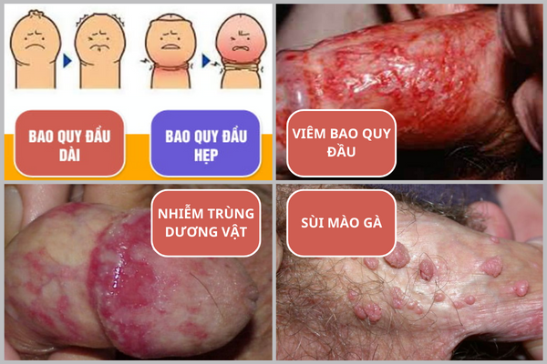 ngua-bao-quy-dau-khong-chi-kho-chiu-con-tiem-an-nguy-hiem-1