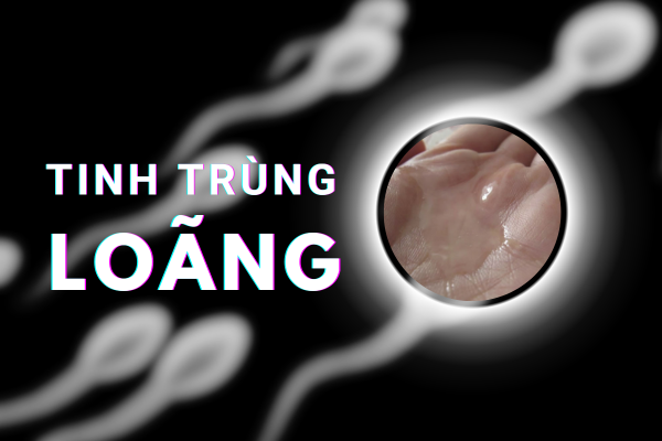Tinh trùng loãng khiến nam giới khó làm cha