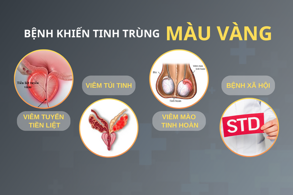 tinh-trung-mau-vang-khong-nen-lo-la-1