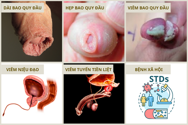 can-than-voi-cac-con-dau-bao-quy-dau-1