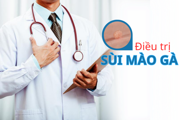 Đâu là phương án điều trị sùi mào gà chính xác?