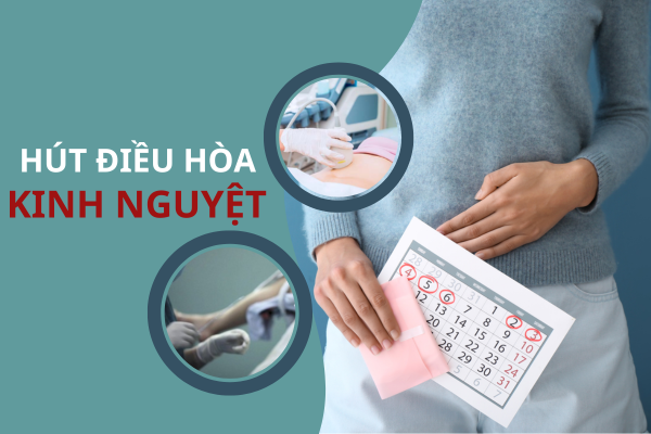 Hút điều hòa kinh nguyệt là gì? Có đảm bảo an toàn không?