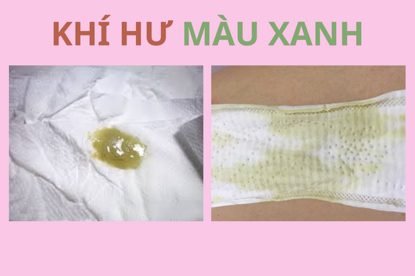 khi-hu-mau-xanh-nguy-hiem-nhu-the-nao-1