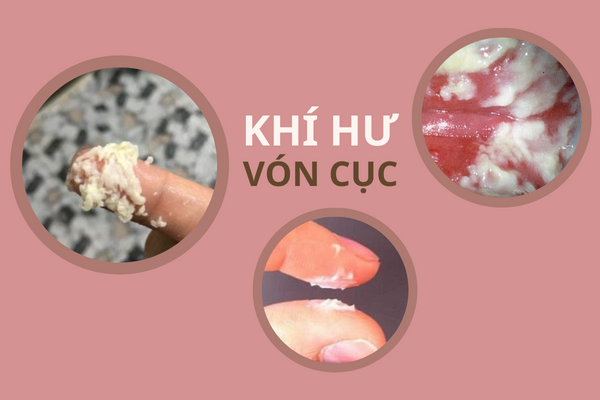 khi-hu-von-cuc-khong-hiem-gap-nhung-rat-nguy-hiem-1