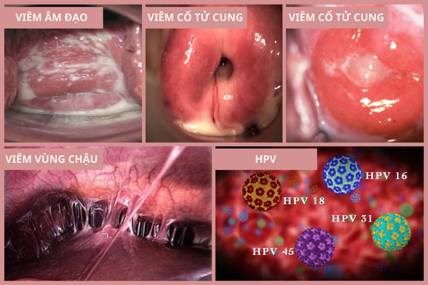 khi-hu-von-cuc-khong-hiem-gap-nhung-rat-nguy-hiem-2
