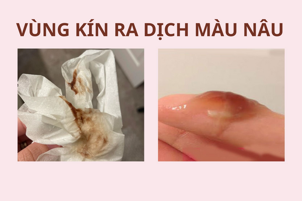 vung-kin-ra-dich-mau-nau-canh-bao-van-de-phu-khoa-1