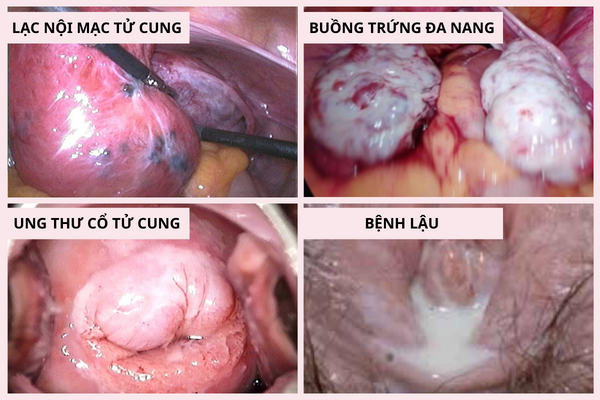 vung-kin-ra-dich-mau-nau-canh-bao-van-de-phu-khoa-3