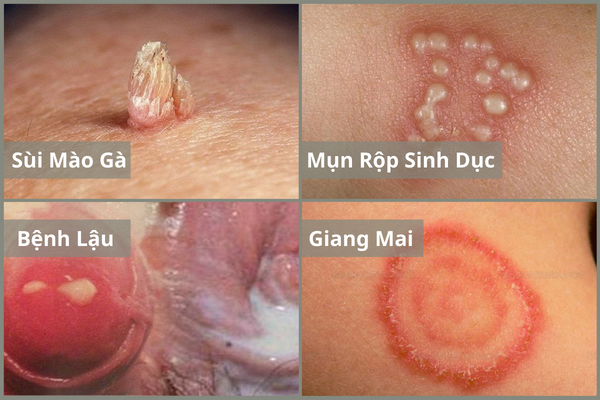 canh-bao-tinh-trang-noi-hach-o-mep-am-dao-2