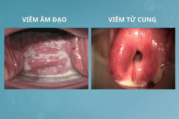 het-kinh-lai-ra-mau-dang-gap-van-de-gi-1