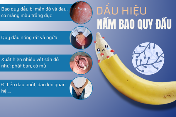bao-dong-tinh-trang-nam-bao-quy-dau-2