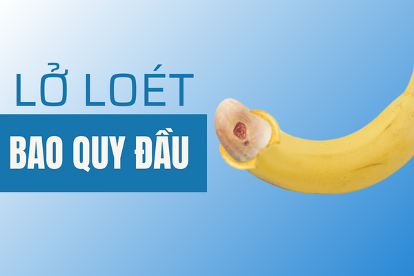 Lở loét bao quy đầu cảnh báo nguy hiểm