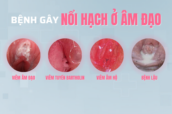 ly-do-bi-noi-hach-o-am-dao-va-cach-xu-ly-hieu-qua-1