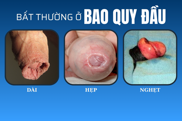 noi-mun-bao-quy-dau-canh-bao-dieu-gi-1