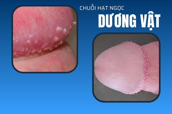 noi-mun-bao-quy-dau-canh-bao-dieu-gi-3