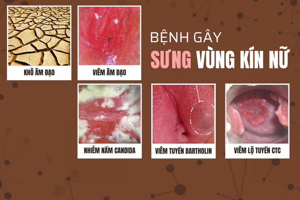 sung-vung-kin-nu-la-do-dau-1