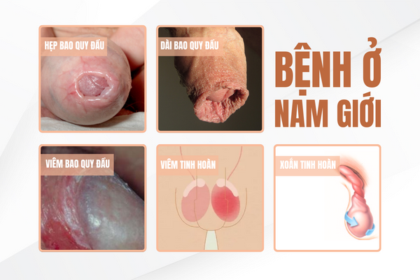 dau-rat-vung-kin-canh-bao-benh-gi-va-lam-sao-khac-phuc-1
