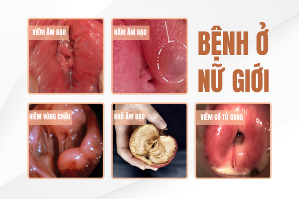 dau-rat-vung-kin-canh-bao-benh-gi-va-lam-sao-khac-phuc-2