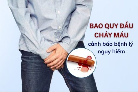 Bao quy đầu chảy máu – 5 thủ phạm âm thầm quý ông thường bỏ qua