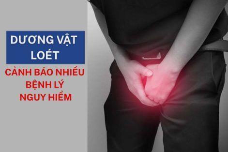 Dương vật lở loét – dấu hiệu cảnh báo 5 bệnh lý nguy hiểm