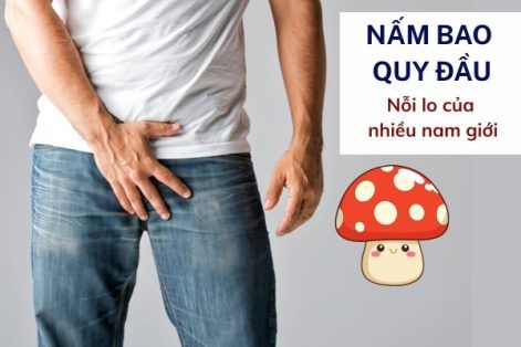 Nấm bao quy đầu là bệnh gì có nguy hiểm không?