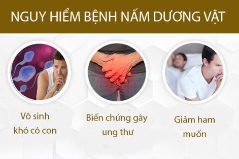 Nấm dương vật bệnh lý phổ biến nhưng tiềm ẩn nhiều biến chứng