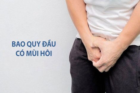 Quy đầu có mùi bất thường làm sao để hết?